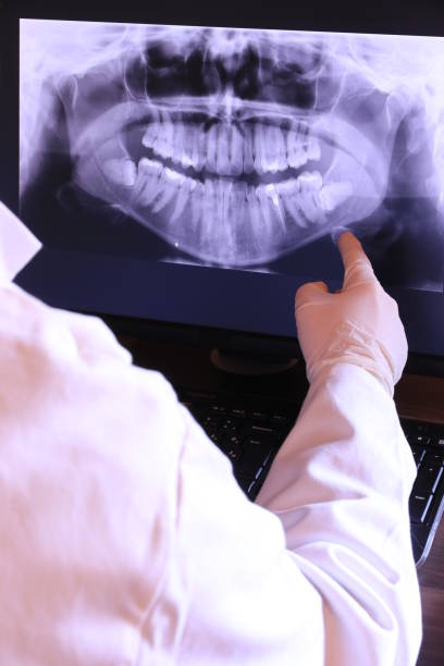 Best Emergency Root Canal Treatment in Odell, OR