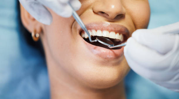 Best Emergency Treatment for Toothache in Odell, OR